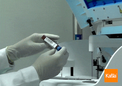 gif-biossays-kabla-02