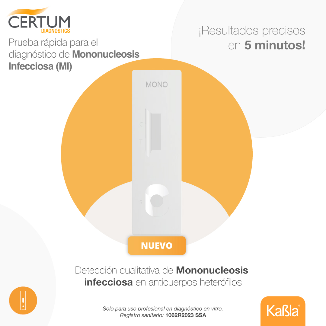 Prueba-rapida-cualitativa-para-deteccion-de-mononucleosis-certuma-kabla-