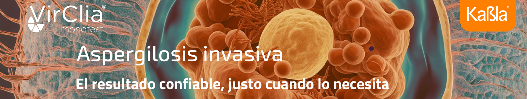 inmunologia-quimioluminiscencia-aspergillus-galactomanano-virclia-vircell-banner