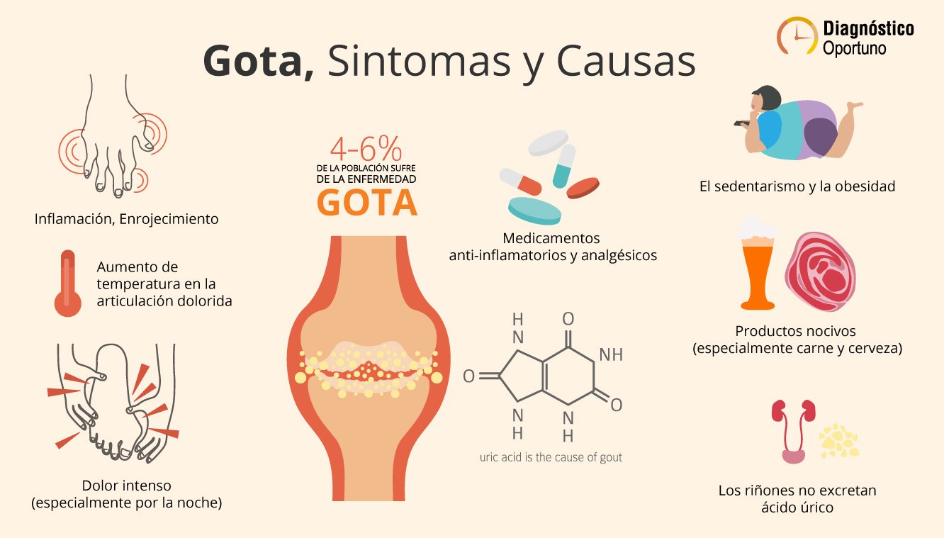 Gota-sintomas-y-causas