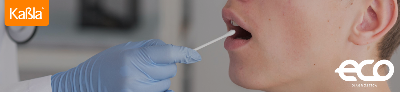 pruebas-rapidas-enfermedades-infecciosas-transmision-sexual-prueba-rapida-vih-en-saliva-eco-diagnostica-movil-r3