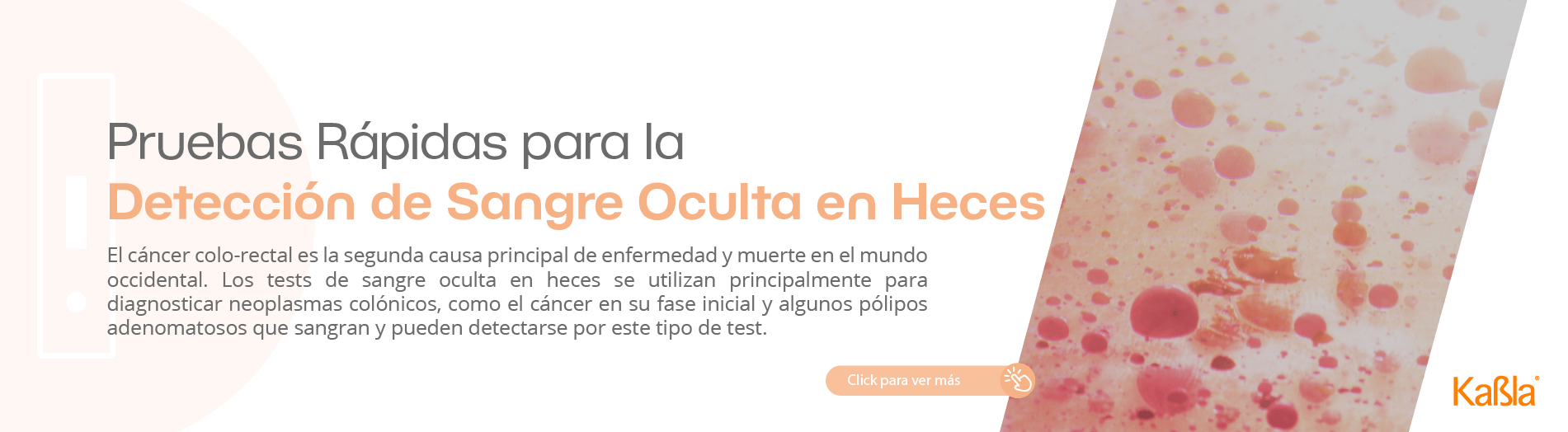 Banner-movil-pruebas-rapidas-marcadores-tumorales-e-inflamatorios-sangre-oculta-en-heces