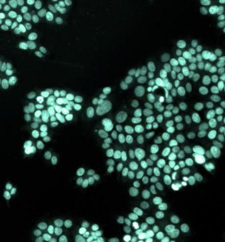 morfologia-y-lecturas-multiomicas-aviti24-element-biosciences