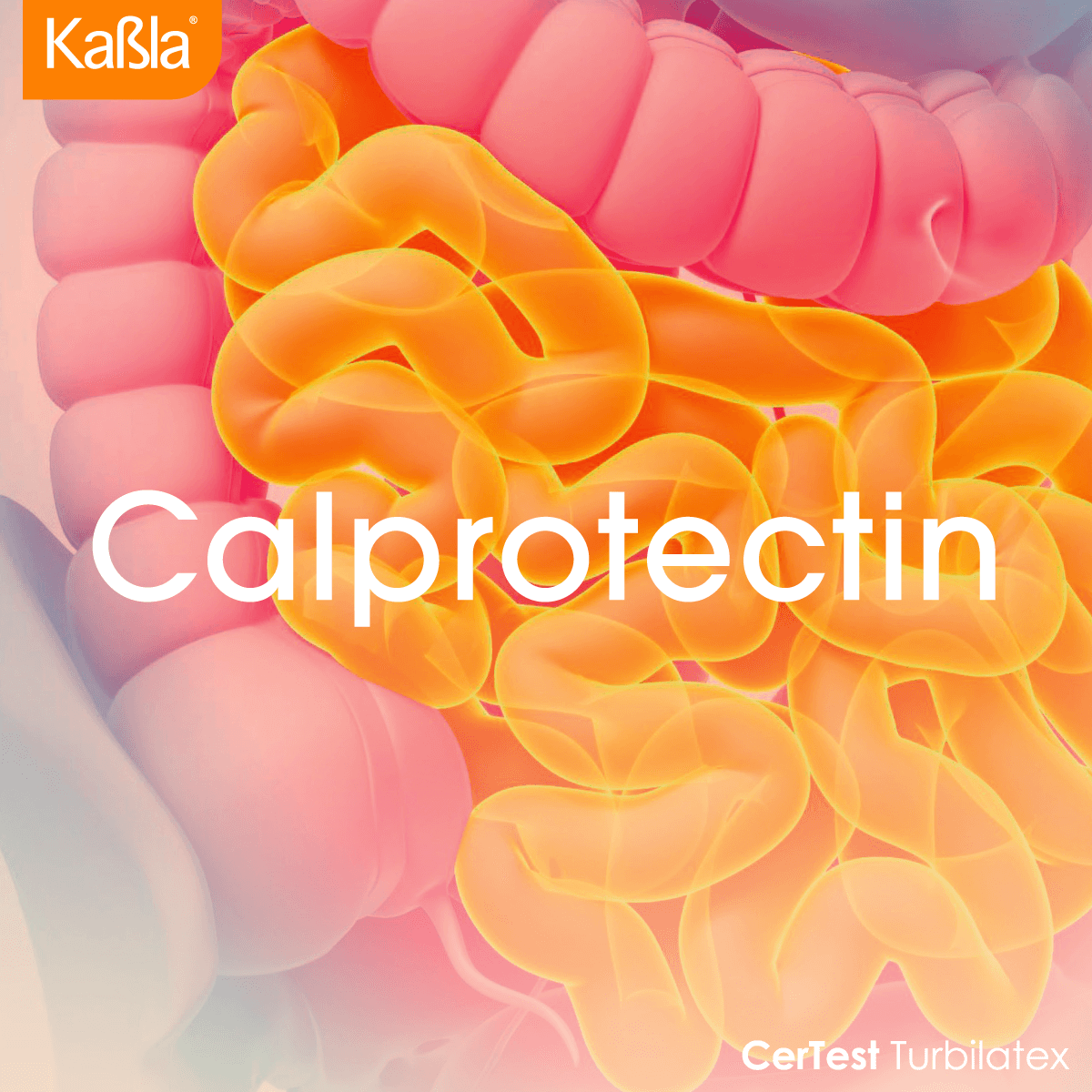 banner-bioquimica-turbidimetria-turbilatex-certest-calprotectin-movil-1200x1200