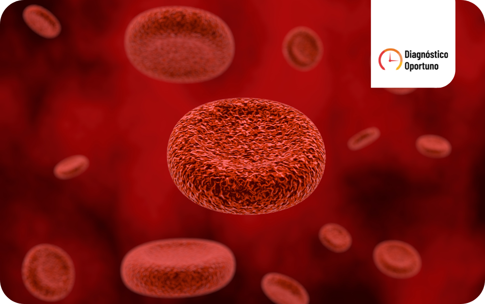 Metahemoglobinemia adquirida