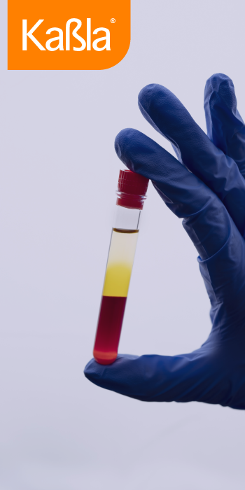 img-bioquimica-integral-coagulacion-paso-1